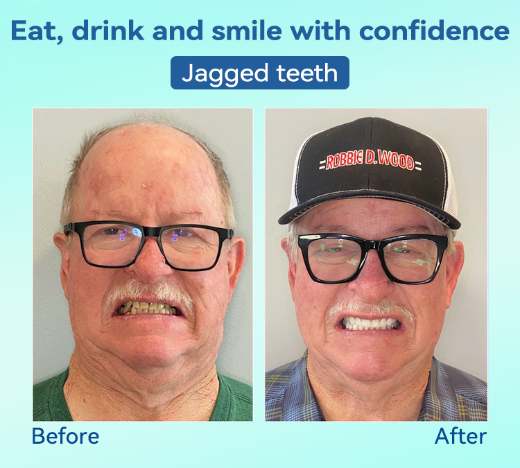 𝐁𝐢𝐤𝐞𝐧𝐝𝐚®✅𝐏𝐫𝐞𝐦𝐢𝐮𝐦 𝐃𝐞𝐧𝐭𝐮𝐫𝐞(🦷𝐋𝐢𝐦𝐢𝐭𝐞𝐝 𝐭𝐢𝐦𝐞 𝐝𝐢𝐬𝐜𝐨𝐮𝐧𝐭 𝐋𝐚𝐬𝐭 𝟑𝟎 𝐦𝐢𝐧𝐮𝐭𝐞𝐬🦷)