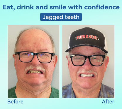 𝐁𝐢𝐤𝐞𝐧𝐝𝐚®✅𝐏𝐫𝐞𝐦𝐢𝐮𝐦 𝐃𝐞𝐧𝐭𝐮𝐫𝐞(🦷𝐋𝐢𝐦𝐢𝐭𝐞𝐝 𝐭𝐢𝐦𝐞 𝐝𝐢𝐬𝐜𝐨𝐮𝐧𝐭 𝐋𝐚𝐬𝐭 𝟑𝟎 𝐦𝐢𝐧𝐮𝐭𝐞𝐬🦷)