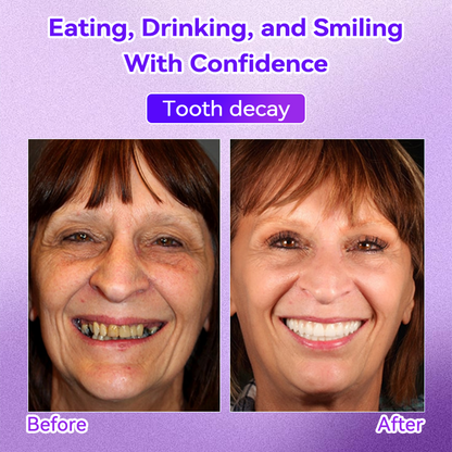 𝐎𝐲𝐢𝐤𝐞𝐲® Mineral Whitening Tooth Powder 🦷  (🎁 Exclusive Promotion - 60% Off)