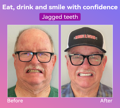 𝐉𝐚𝐬𝐬𝐞𝐞𝐦® Latest Premium Comfort Dentures🌌(High-End Dentures, Easy to Wear - Limited Time 70% Discount)