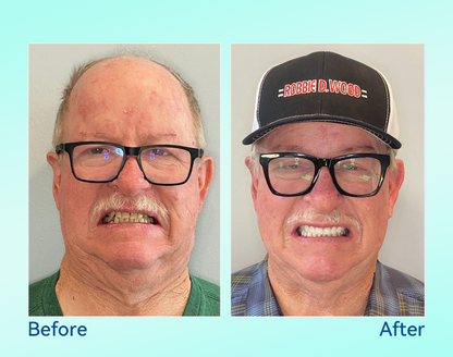 🔥 Only 4 boxes left! Enjoy an extra 50% off! Recommended by dentists, 🍀𝐁𝐢𝐤𝐞𝐧𝐝𝐚® ensures your oral health so you can enjoy meals safely and naturally. Don’t miss out—act now or wait until next year! Enhance your oral health today!