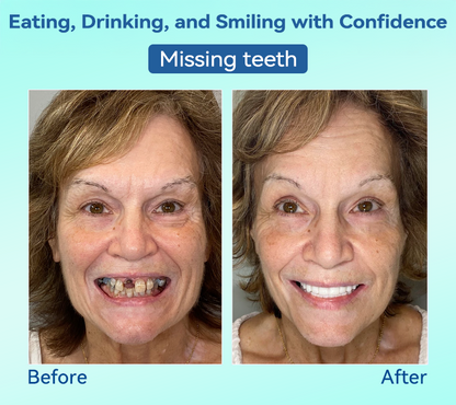𝐁𝐢𝐤𝐞𝐧𝐝𝐚®✅𝐏𝐫𝐞𝐦𝐢𝐮𝐦 𝐃𝐞𝐧𝐭𝐮𝐫𝐞(🦷𝐋𝐢𝐦𝐢𝐭𝐞𝐝 𝐭𝐢𝐦𝐞 𝐝𝐢𝐬𝐜𝐨𝐮𝐧𝐭 𝐋𝐚𝐬𝐭 𝟑𝟎 𝐦𝐢𝐧𝐮𝐭𝐞𝐬🦷)