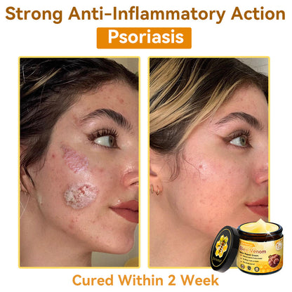 （🚚 Made & Shipped in the USA ✅） 𝐃𝐨𝐫𝐦𝐨𝐫𝐧𝐚® 💕 Bee Venom Repair Cream Last Day – 70% OFF! 🔥
