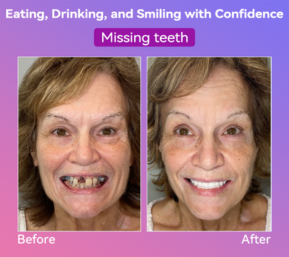 𝐉𝐚𝐬𝐬𝐞𝐞𝐦® Latest Premium Comfort Dentures🌌(High-End Dentures, Easy to Wear - Limited Time 70% Discount)