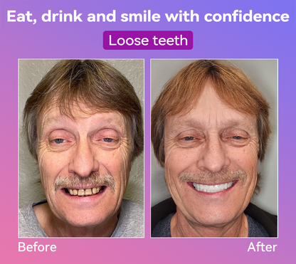 𝐉𝐚𝐬𝐬𝐞𝐞𝐦® Latest Premium Comfort Dentures🌌(High-End Dentures, Easy to Wear - Limited Time 70% Discount)