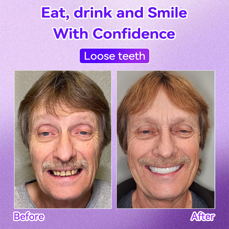 𝐎𝐲𝐢𝐤𝐞𝐲® Mineral Whitening Tooth Powder 🦷  (🎁 Exclusive Promotion - 60% Off)