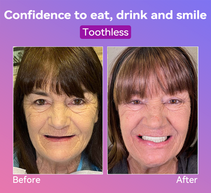 𝐉𝐚𝐬𝐬𝐞𝐞𝐦® Latest Premium Comfort Dentures🌌(High-End Dentures, Easy to Wear - Limited Time 70% Discount)