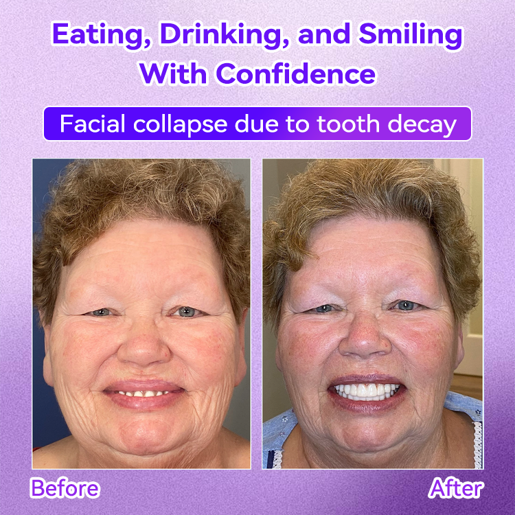 𝐎𝐲𝐢𝐤𝐞𝐲® Mineral Whitening Tooth Powder 🦷  (🎁 Exclusive Promotion - 60% Off)