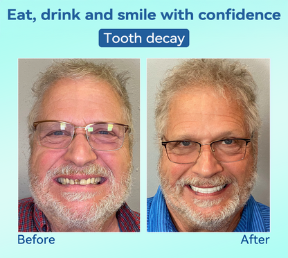 𝐁𝐢𝐤𝐞𝐧𝐝𝐚®✅𝐏𝐫𝐞𝐦𝐢𝐮𝐦 𝐃𝐞𝐧𝐭𝐮𝐫𝐞(🦷𝐋𝐢𝐦𝐢𝐭𝐞𝐝 𝐭𝐢𝐦𝐞 𝐝𝐢𝐬𝐜𝐨𝐮𝐧𝐭 𝐋𝐚𝐬𝐭 𝟑𝟎 𝐦𝐢𝐧𝐮𝐭𝐞𝐬🦷)