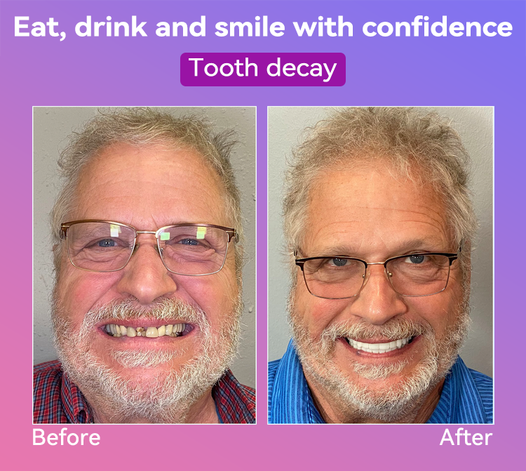𝐉𝐚𝐬𝐬𝐞𝐞𝐦® Latest Premium Comfort Dentures🌌(High-End Dentures, Easy to Wear - Limited Time 70% Discount)