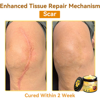 （🚚 Made & Shipped in the USA ✅） 𝐃𝐨𝐫𝐦𝐨𝐫𝐧𝐚® 💕 Bee Venom Repair Cream Last Day – 70% OFF! 🔥