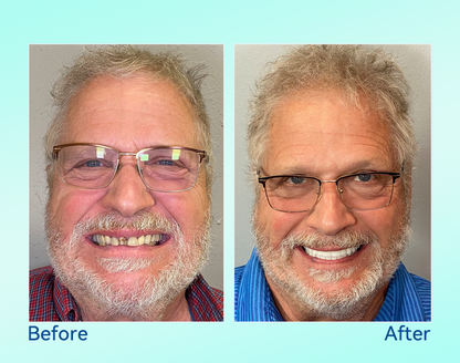 🔥 Only 4 boxes left! Enjoy an extra 50% off! Recommended by dentists, 🍀𝐁𝐢𝐤𝐞𝐧𝐝𝐚® ensures your oral health so you can enjoy meals safely and naturally. Don’t miss out—act now or wait until next year! Enhance your oral health today!