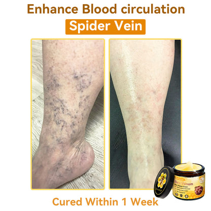 （🚚 Made & Shipped in the USA ✅） 𝐃𝐨𝐫𝐦𝐨𝐫𝐧𝐚® 💕 Bee Venom Repair Cream Last Day – 70% OFF! 🔥