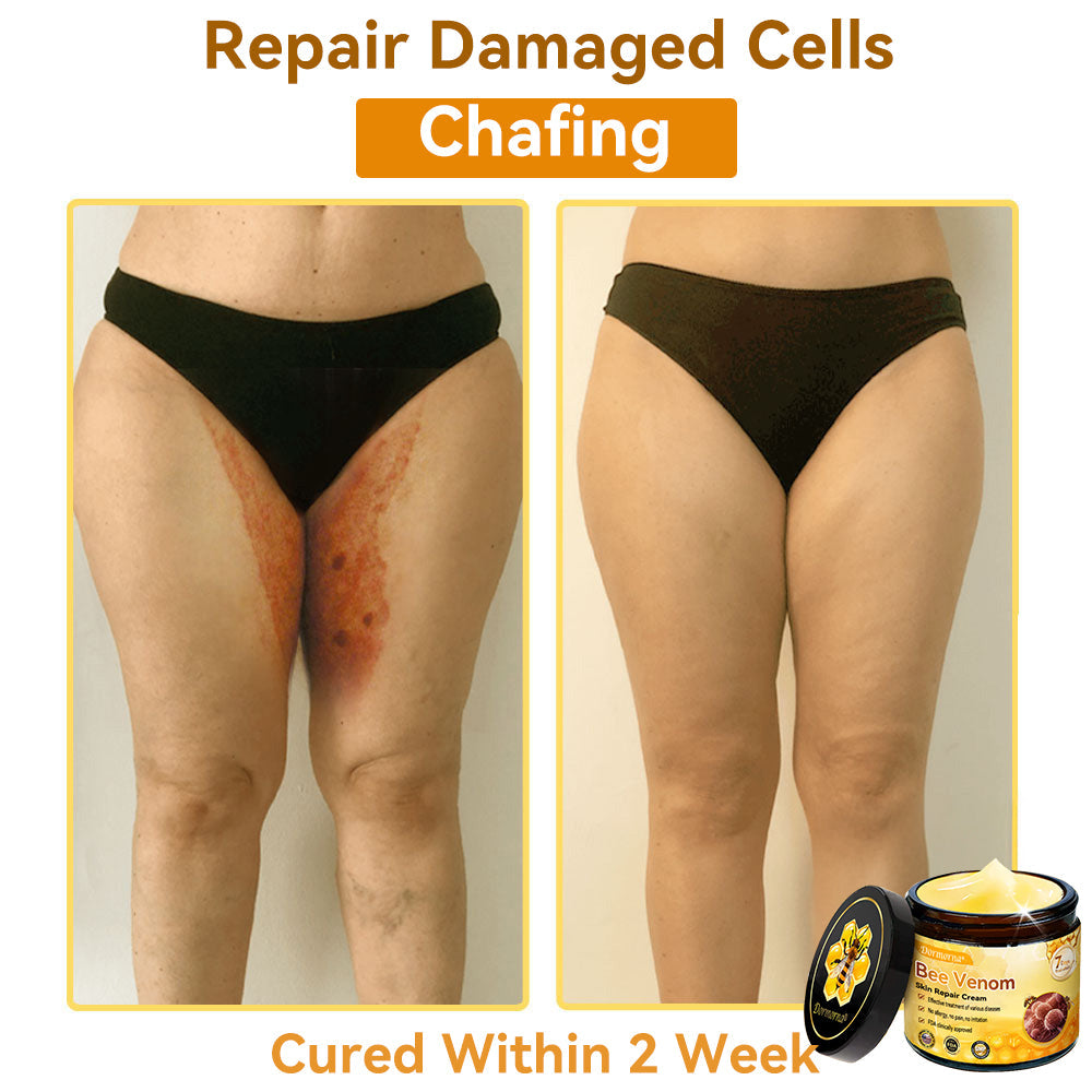 （🚚 Made & Shipped in the USA ✅） 𝐃𝐨𝐫𝐦𝐨𝐫𝐧𝐚® 💕 Bee Venom Repair Cream Last Day – 70% OFF! 🔥