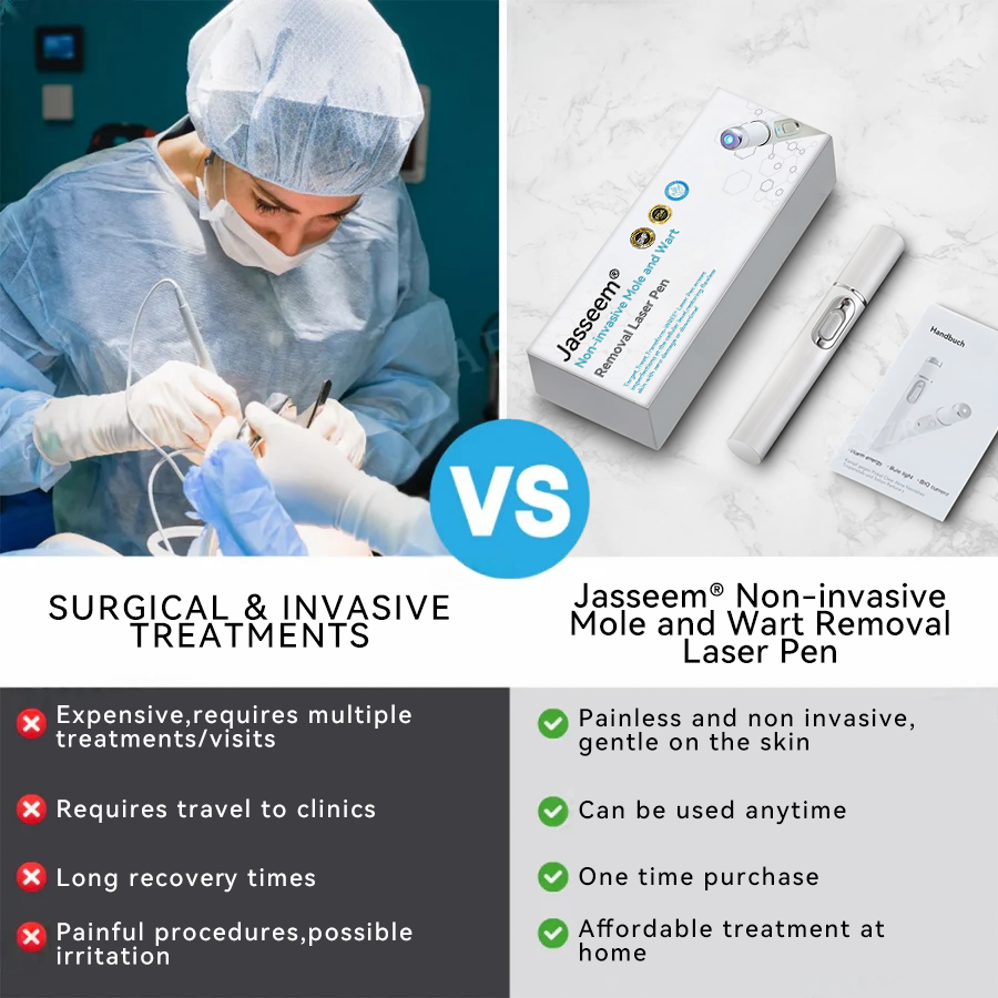 𝐉𝐚𝐬𝐬𝐞𝐞𝐦® 💛Non-invasive Mole and Wart Removal Laser Pen (Quick and painless removal of warts, moles, age spots and skin tags - without any side effects)