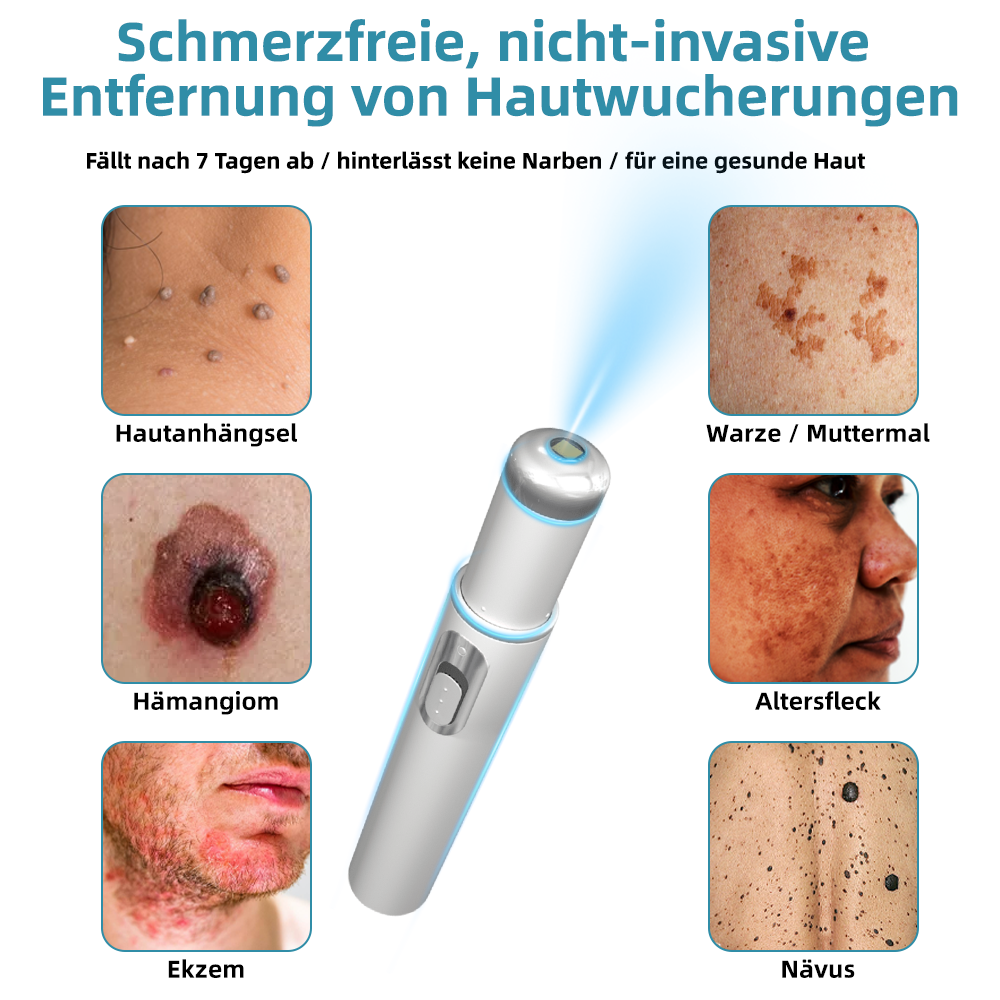 𝐁i𝐤e𝐧da® N𝐢ch𝐭-i𝐧va𝐬iv 𝐋𝐞b𝐞rfl𝐞ck- 𝐮𝐧𝐝 𝐖𝐚rz𝐞n𝐞n𝐭f𝐞r𝐧𝐮𝐧g𝐬-La𝐬𝐞r𝐬tift 𝐏𝐫o𝐦ox🔥