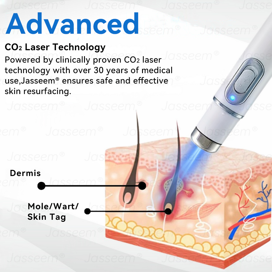 𝐉𝐚𝐬𝐬𝐞𝐞𝐦®🧡𝐍𝐨𝐧-𝐈𝐧𝐯𝐚𝐬𝐢𝐯𝐞 𝐌𝐨𝐥𝐞 & 𝐖𝐚𝐫𝐭 𝐋𝐚𝐬𝐞𝐫 𝐑𝐞𝐦𝐨𝐯𝐚𝐥 𝐏𝐞𝐧 (𝐩𝐚𝐢𝐧𝐥𝐞𝐬𝐬 𝐫𝐞𝐦𝐨𝐯𝐚𝐥 𝐨𝐟 𝐰𝐚𝐫𝐭𝐬, 𝐦𝐨𝐥𝐞𝐬, 𝐚𝐠𝐞 𝐬𝐩𝐨𝐭𝐬, 𝐚𝐧𝐝 𝐬𝐤𝐢𝐧 𝐭𝐚𝐠𝐬)