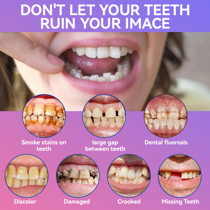𝐉𝐚𝐬𝐬𝐞𝐞𝐦® Latest Premium Comfort Dentures🌌(High-End Dentures, Easy to Wear - Limited Time 70% Discount)