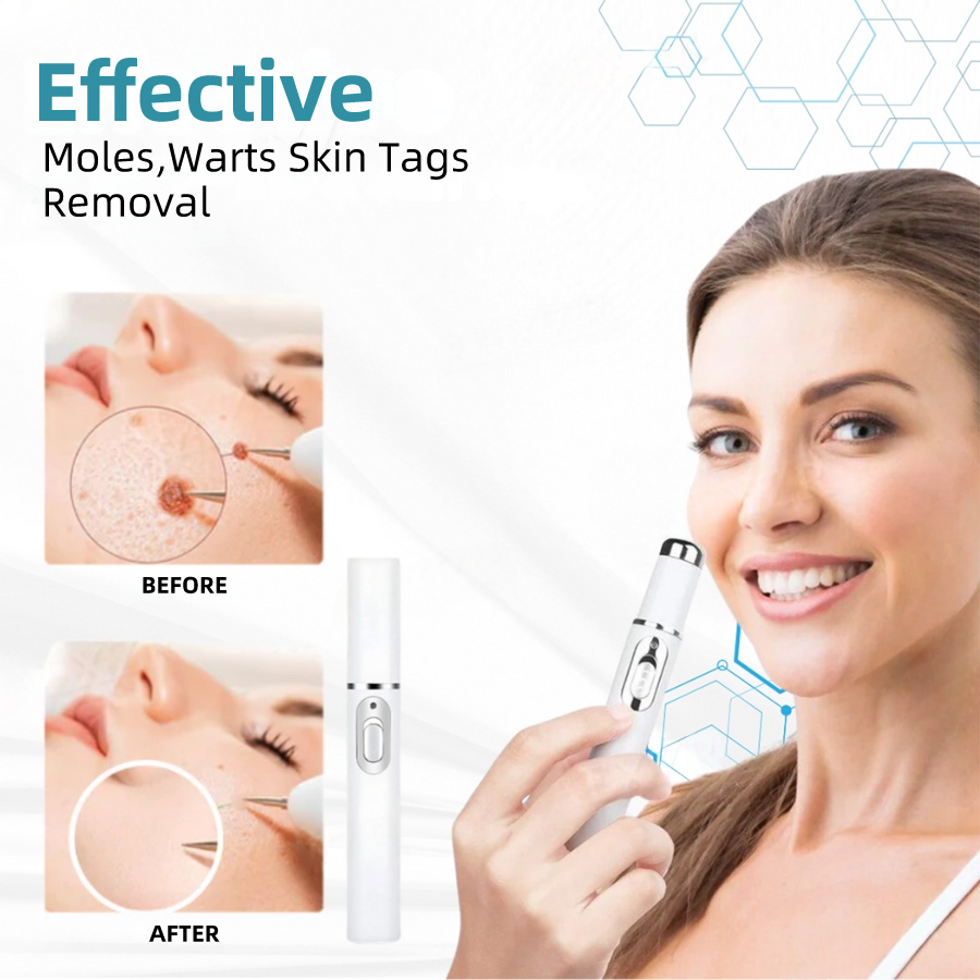 𝐉𝐚𝐬𝐬𝐞𝐞𝐦® Medical-Grade Laser Pen 🎉 (Powered by CO₂ laser technology – effectively removes moles, warts, skin tags, pigmentation spots, and other skin imperfections)🔥