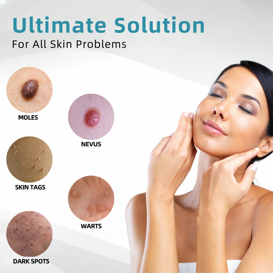 𝐉𝐚𝐬𝐬𝐞𝐞𝐦® Medical-Grade Laser Pen 🎉 (Powered by CO₂ laser technology – effectively removes moles, warts, skin tags, pigmentation spots, and other skin imperfections)🔥