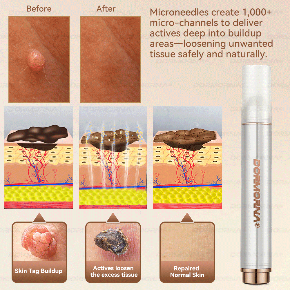 𝐷𝑂𝑅𝑀𝑂𝑅𝑁𝐴® 💕 Stem Cell PDRN Repair Milk | With 2000PPM Exosome‑Coated Micro‑Spicules 👩‍⚕️