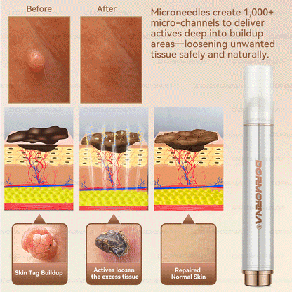 𝐷𝑂𝑅𝑀𝑂𝑅𝑁𝐴® 💕 Stem Cell PDRN Repair Milk | With 2000PPM Exosome‑Coated Micro‑Spicules 👩‍⚕️