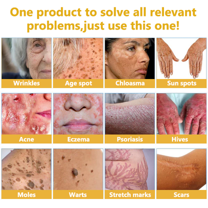 𝓕𝓪𝓽𝓸𝓷𝓰® Bee Venom Skin Repair Essence Ampoules 💕(Effectively improves moles, warts, skin tags, dark spots, and other skin imperfections)