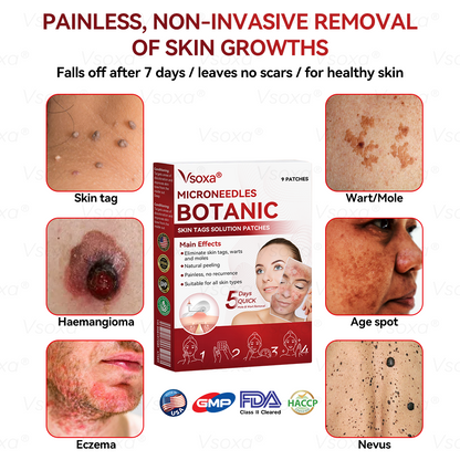 𝑉𝑠𝑜𝑥𝑎® 💧Microneedles Botanical Skin Tags Solution Patches - Made in the USA