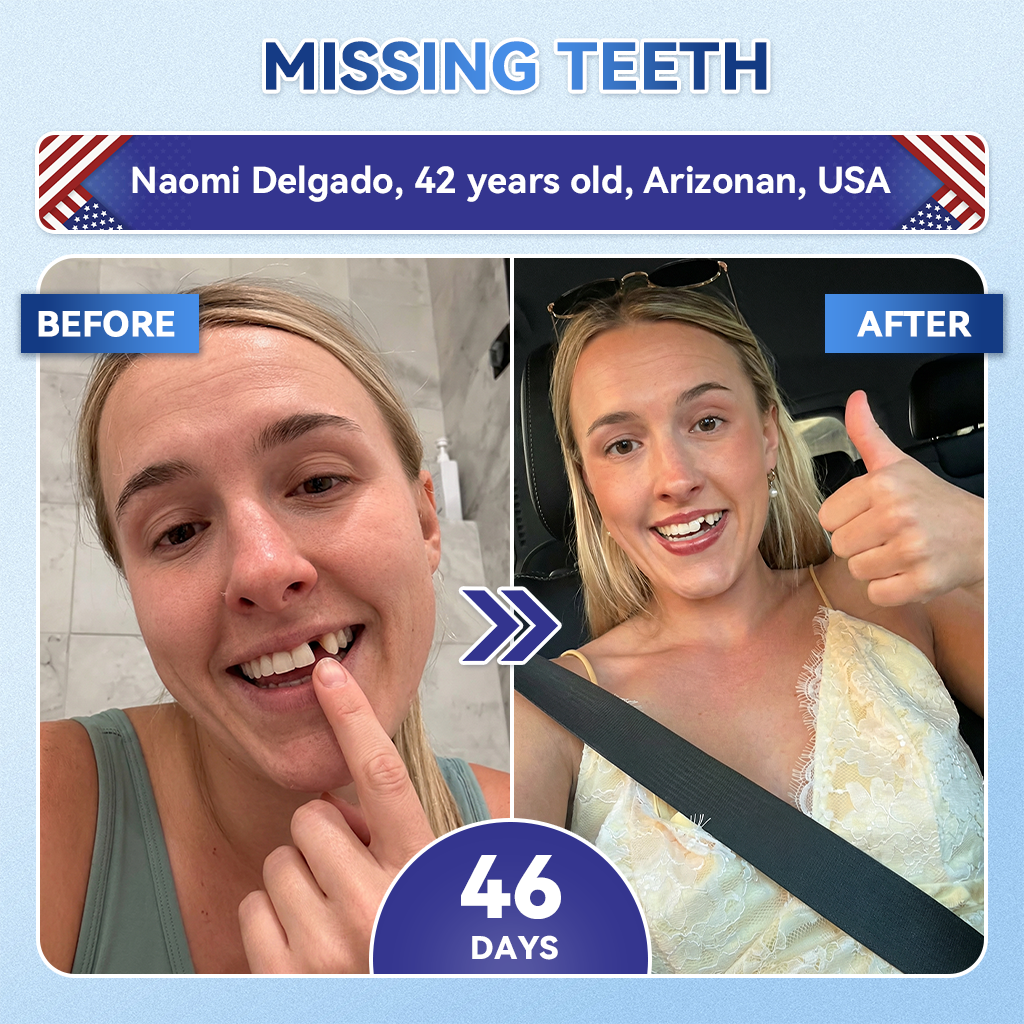 🦷𝐆𝐥𝐢𝐦𝐦𝐞𝐫𝐥𝐲® 🍉𝐓𝐢𝐝𝐞𝐠𝐥𝐮𝐬𝐢𝐛 𝐓𝐨𝐨𝐭𝐡 & 𝐆𝐮𝐦 𝐑𝐞𝐩𝐚𝐢𝐫 𝐌𝐢𝐜𝐫𝐨𝐧𝐞𝐞𝐝𝐥𝐞 𝐏𝐚𝐭𝐜𝐡  | 𝐀𝐝𝐯𝐚𝐧𝐜𝐞𝐝 𝐒𝐭𝐞𝐦-𝐂𝐞𝐥𝐥 𝐀𝐜𝐭𝐢𝐯𝐚𝐭𝐢𝐨𝐧 𝐓𝐞𝐞𝐭𝐡 𝐒𝐭𝐫𝐢𝐩𝐬(🦷𝐑𝐞𝐛𝐮𝐢𝐥𝐝 𝐄𝐧𝐚𝐦𝐞𝐥 & 𝐃𝐞𝐧𝐭𝐢𝐧 • 𝐒𝐭𝐫𝐞𝐧𝐠𝐭𝐡𝐞𝐧 𝐆𝐮𝐦𝐬 • 𝐄𝐫𝐚𝐝𝐢𝐜𝐚𝐭𝐞 𝐓𝐚𝐫𝐭𝐚𝐫 & 𝐎𝐝𝐨𝐫 • 𝐒𝐭𝐨𝐩 𝐓𝐨𝐨𝐭𝐡 𝐒𝐞𝐧𝐬𝐢𝐭𝐢𝐯𝐢𝐭𝐲)