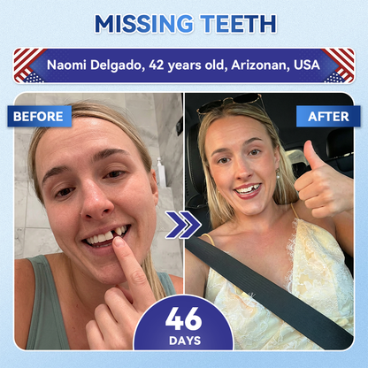 🦷𝐆𝐥𝐢𝐦𝐦𝐞𝐫𝐥𝐲® 🍉𝐓𝐢𝐝𝐞𝐠𝐥𝐮𝐬𝐢𝐛 𝐓𝐨𝐨𝐭𝐡 & 𝐆𝐮𝐦 𝐑𝐞𝐩𝐚𝐢𝐫 𝐌𝐢𝐜𝐫𝐨𝐧𝐞𝐞𝐝𝐥𝐞 𝐏𝐚𝐭𝐜𝐡  | 𝐀𝐝𝐯𝐚𝐧𝐜𝐞𝐝 𝐒𝐭𝐞𝐦-𝐂𝐞𝐥𝐥 𝐀𝐜𝐭𝐢𝐯𝐚𝐭𝐢𝐨𝐧 𝐓𝐞𝐞𝐭𝐡 𝐒𝐭𝐫𝐢𝐩𝐬(🦷𝐑𝐞𝐛𝐮𝐢𝐥𝐝 𝐄𝐧𝐚𝐦𝐞𝐥 & 𝐃𝐞𝐧𝐭𝐢𝐧 • 𝐒𝐭𝐫𝐞𝐧𝐠𝐭𝐡𝐞𝐧 𝐆𝐮𝐦𝐬 • 𝐄𝐫𝐚𝐝𝐢𝐜𝐚𝐭𝐞 𝐓𝐚𝐫𝐭𝐚𝐫 & 𝐎𝐝𝐨𝐫 • 𝐒𝐭𝐨𝐩 𝐓𝐨𝐨𝐭𝐡 𝐒𝐞𝐧𝐬𝐢𝐭𝐢𝐯𝐢𝐭𝐲)