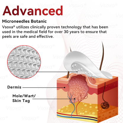 🛡️ 𝑉𝑠𝑜𝑥𝑎®  Microneedle Botanical Skin Tag Repair Patches 🎁🎁