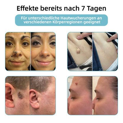 𝐁i𝐤e𝐧da® N𝐢ch𝐭-i𝐧va𝐬iv 𝐋𝐞b𝐞rfl𝐞ck- 𝐮𝐧𝐝 𝐖𝐚rz𝐞n𝐞n𝐭f𝐞r𝐧𝐮𝐧g𝐬-La𝐬𝐞r𝐬tift 𝐏𝐫o𝐦ox🔥