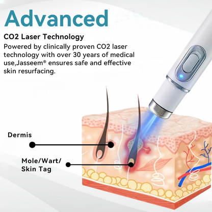𝐉𝐚𝐬𝐬𝐞𝐞𝐦® Medical-Grade Laser Pen 🎉 (Powered by CO₂ laser technology – effectively removes moles, warts, skin tags, pigmentation spots, and other skin imperfections)🏆
