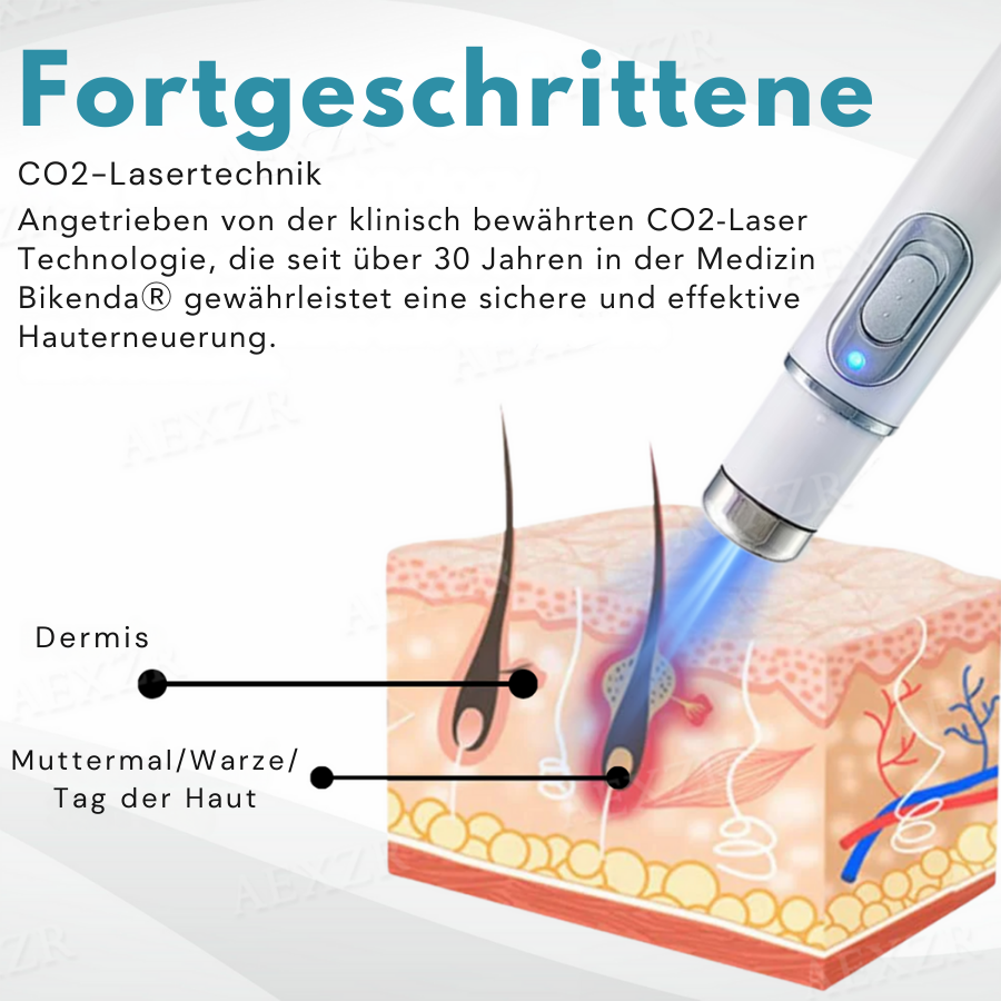 𝐁i𝐤e𝐧da® N𝐢ch𝐭-i𝐧va𝐬iv 𝐋𝐞b𝐞rfl𝐞ck- 𝐮𝐧𝐝 𝐖𝐚rz𝐞n𝐞n𝐭f𝐞r𝐧𝐮𝐧g𝐬-La𝐬𝐞r𝐬tift 𝐏𝐫o𝐦ox🔥