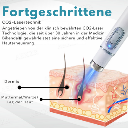 𝐁i𝐤e𝐧da® N𝐢ch𝐭-i𝐧va𝐬iv 𝐋𝐞b𝐞rfl𝐞ck- 𝐮𝐧𝐝 𝐖𝐚rz𝐞n𝐞n𝐭f𝐞r𝐧𝐮𝐧g𝐬-La𝐬𝐞r𝐬tift 𝐏𝐫o𝐦ox🔥