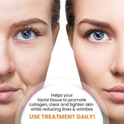 (🔥LAST DAY 70% OFF 🔥) Korean Technology Soluble Collagen Film