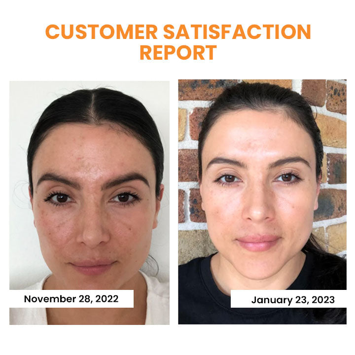 (🔥LAST DAY 70% OFF 🔥) Korean Technology Soluble Collagen Film