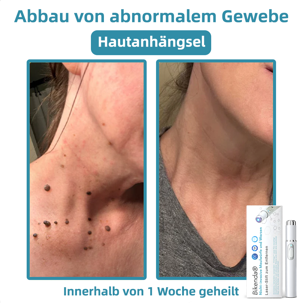 𝐁i𝐤e𝐧da® N𝐢ch𝐭-i𝐧va𝐬iv 𝐋𝐞b𝐞rfl𝐞ck- 𝐮𝐧𝐝 𝐖𝐚rz𝐞n𝐞n𝐭f𝐞r𝐧𝐮𝐧g𝐬-La𝐬𝐞r𝐬tift 𝐏𝐫o𝐦ox🔥