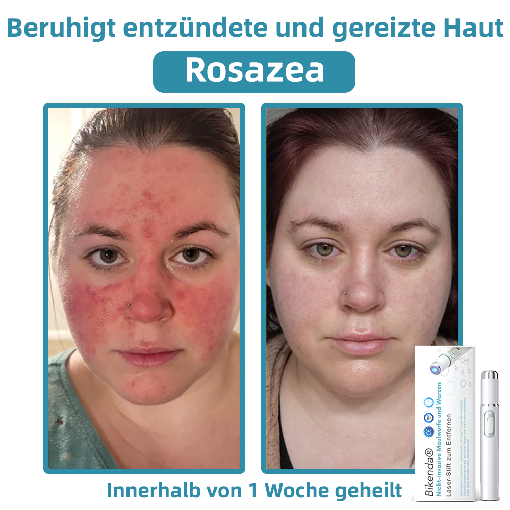 𝐁i𝐤e𝐧da® N𝐢ch𝐭-i𝐧va𝐬iv 𝐋𝐞b𝐞rfl𝐞ck- 𝐮𝐧𝐝 𝐖𝐚rz𝐞n𝐞n𝐭f𝐞r𝐧𝐮𝐧g𝐬-La𝐬𝐞r𝐬tift 𝐏𝐫o𝐦ox🔥