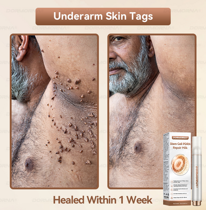 Dormorna® Stem Cell PDRN Repair Milk 💕 | With 2000PPM Exosome‑Coated Micro‑Spicules 🏆