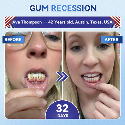 🦷𝐆𝐥𝐢𝐦𝐦𝐞𝐫𝐥𝐲® 🍉𝐓𝐢𝐝𝐞𝐠𝐥𝐮𝐬𝐢𝐛 𝐓𝐨𝐨𝐭𝐡 & 𝐆𝐮𝐦 𝐑𝐞𝐩𝐚𝐢𝐫 𝐌𝐢𝐜𝐫𝐨𝐧𝐞𝐞𝐝𝐥𝐞 𝐏𝐚𝐭𝐜𝐡  | 𝐀𝐝𝐯𝐚𝐧𝐜𝐞𝐝 𝐒𝐭𝐞𝐦-𝐂𝐞𝐥𝐥 𝐀𝐜𝐭𝐢𝐯𝐚𝐭𝐢𝐨𝐧 𝐓𝐞𝐞𝐭𝐡 𝐒𝐭𝐫𝐢𝐩𝐬(🦷𝐑𝐞𝐛𝐮𝐢𝐥𝐝 𝐄𝐧𝐚𝐦𝐞𝐥 & 𝐃𝐞𝐧𝐭𝐢𝐧 • 𝐒𝐭𝐫𝐞𝐧𝐠𝐭𝐡𝐞𝐧 𝐆𝐮𝐦𝐬 • 𝐄𝐫𝐚𝐝𝐢𝐜𝐚𝐭𝐞 𝐓𝐚𝐫𝐭𝐚𝐫 & 𝐎𝐝𝐨𝐫 • 𝐒𝐭𝐨𝐩 𝐓𝐨𝐨𝐭𝐡 𝐒𝐞𝐧𝐬𝐢𝐭𝐢𝐯𝐢𝐭𝐲)